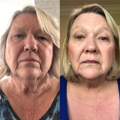 Glovia 7-Color LED Face & Neck Therapy Mask